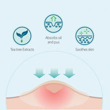 Load image into Gallery viewer, Acne Concealing Patch- 56 Count